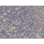 Immunohistochemistry - PIN1 Antibody from Signalway Antibody (32599) - Antibodies.com