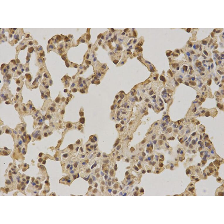 Immunohistochemistry - PIN1 Antibody from Signalway Antibody (32599) - Antibodies.com