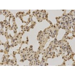 Immunohistochemistry - PIN1 Antibody from Signalway Antibody (32599) - Antibodies.com