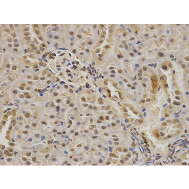 Immunohistochemistry - PIN1 Antibody from Signalway Antibody (32599) - Antibodies.com