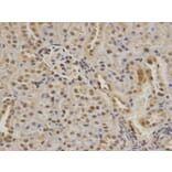 Immunohistochemistry - PIN1 Antibody from Signalway Antibody (32599) - Antibodies.com