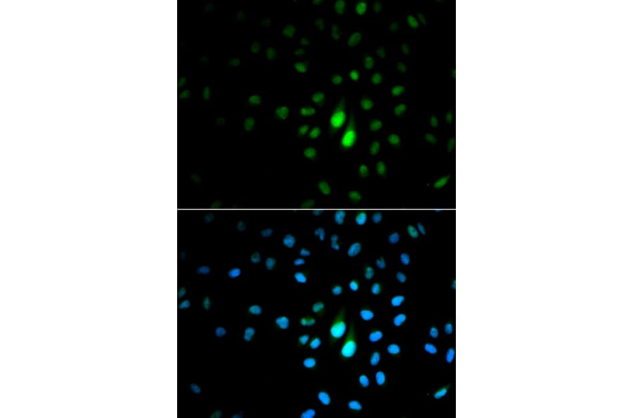 Immunofluorescence - PIN1 Antibody from Signalway Antibody (32599) - Antibodies.com