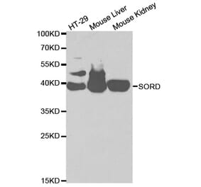 Western blot - SORD Antibody from Signalway Antibody (32609) - Antibodies.com