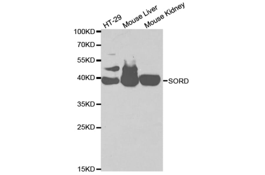 Western blot - SORD Antibody from Signalway Antibody (32609) - Antibodies.com