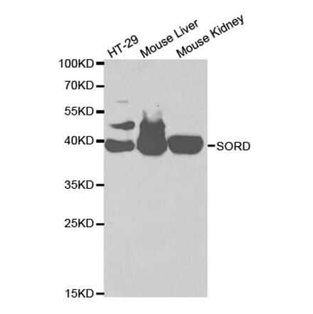 Western blot - SORD Antibody from Signalway Antibody (32609) - Antibodies.com