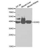 Western blot - SORD Antibody from Signalway Antibody (32609) - Antibodies.com