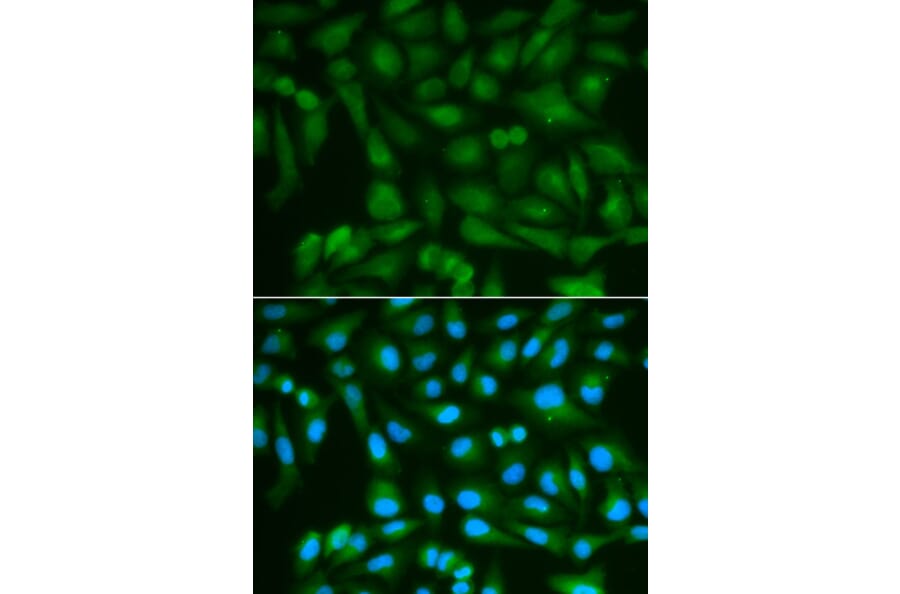 Immunofluorescence - SORD Antibody from Signalway Antibody (32609) - Antibodies.com