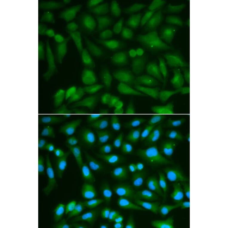 Immunofluorescence - SORD Antibody from Signalway Antibody (32609) - Antibodies.com