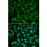 Immunofluorescence - SORD Antibody from Signalway Antibody (32609) - Antibodies.com