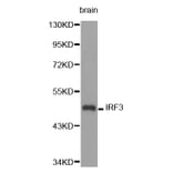 Western blot - IRF3 Antibody from Signalway Antibody (32639) - Antibodies.com
