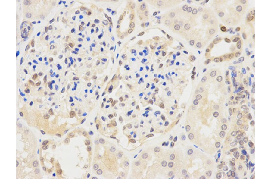 Immunohistochemistry - IRF3 Antibody from Signalway Antibody (32639) - Antibodies.com