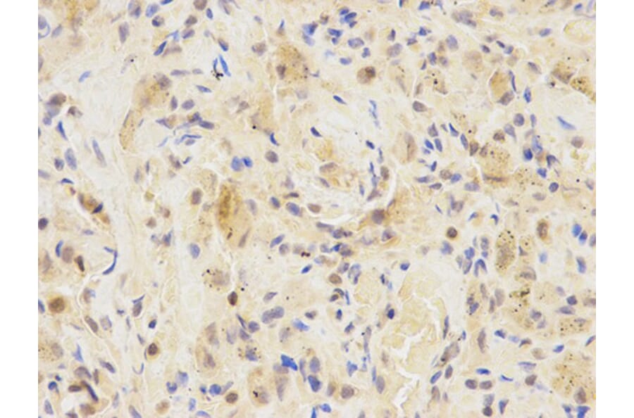 Immunohistochemistry - IRF3 Antibody from Signalway Antibody (32639) - Antibodies.com