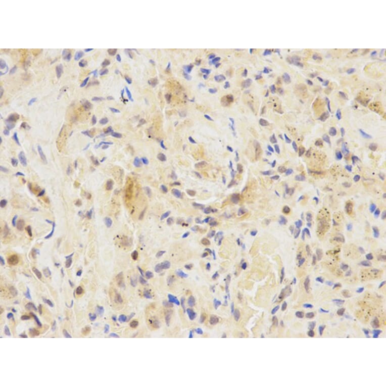 Immunohistochemistry - IRF3 Antibody from Signalway Antibody (32639) - Antibodies.com