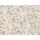 Immunohistochemistry - IRF3 Antibody from Signalway Antibody (32639) - Antibodies.com