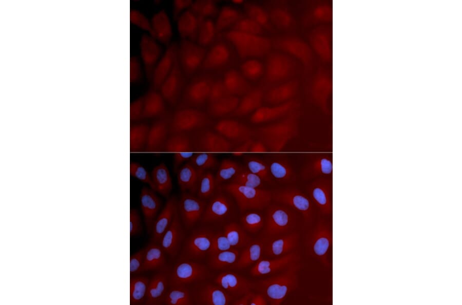 Immunofluorescence - IRF3 Antibody from Signalway Antibody (32639) - Antibodies.com