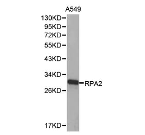 Western blot - RPA2 Antibody from Signalway Antibody (32653) - Antibodies.com