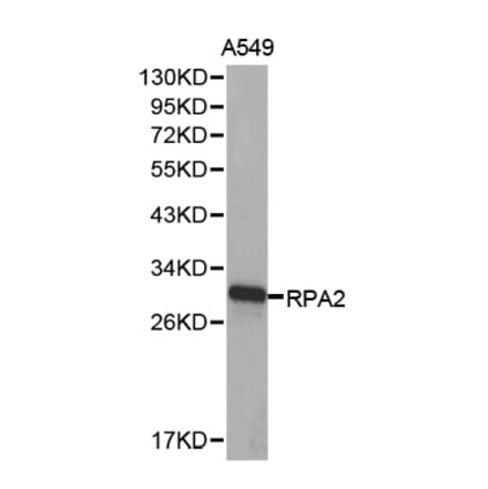 Western blot - RPA2 Antibody from Signalway Antibody (32653) - Antibodies.com