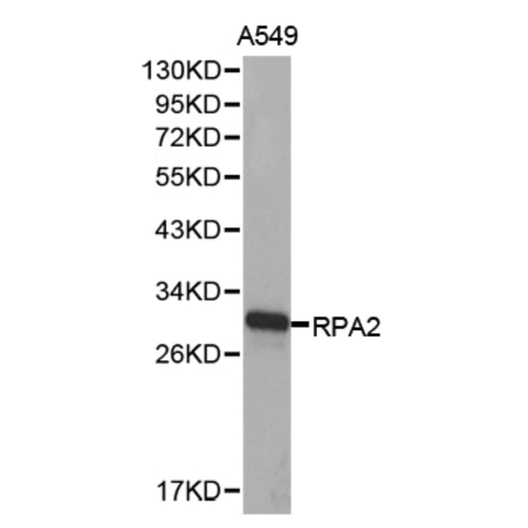 Western blot - RPA2 Antibody from Signalway Antibody (32653) - Antibodies.com