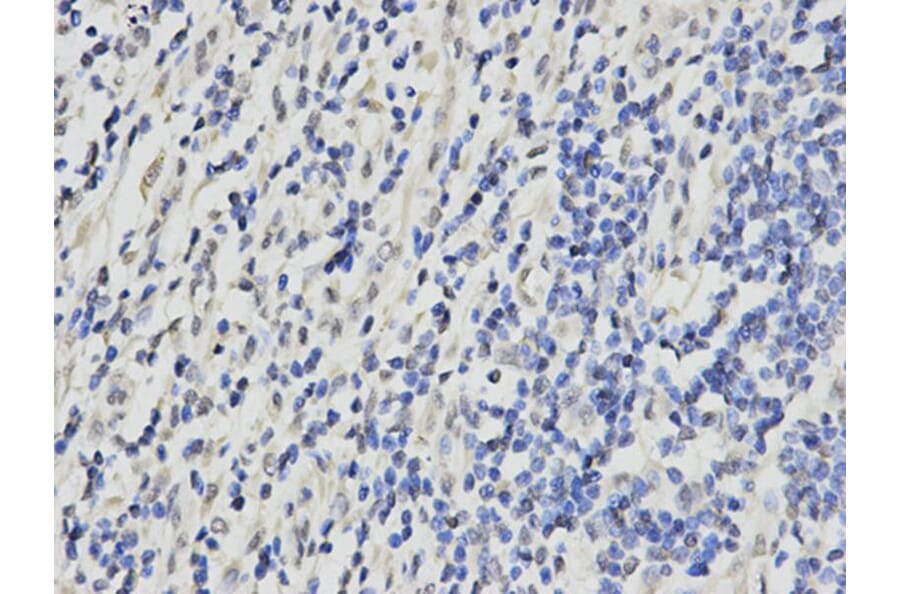 Immunohistochemistry - RPA2 Antibody from Signalway Antibody (32653) - Antibodies.com