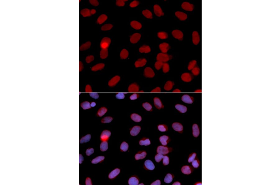 Immunofluorescence - RPA2 Antibody from Signalway Antibody (32653) - Antibodies.com
