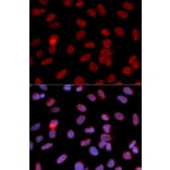 Immunofluorescence - RPA2 Antibody from Signalway Antibody (32653) - Antibodies.com