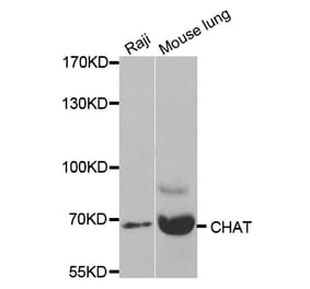 Western blot - CHAT Antibody from Signalway Antibody (32673) - Antibodies.com