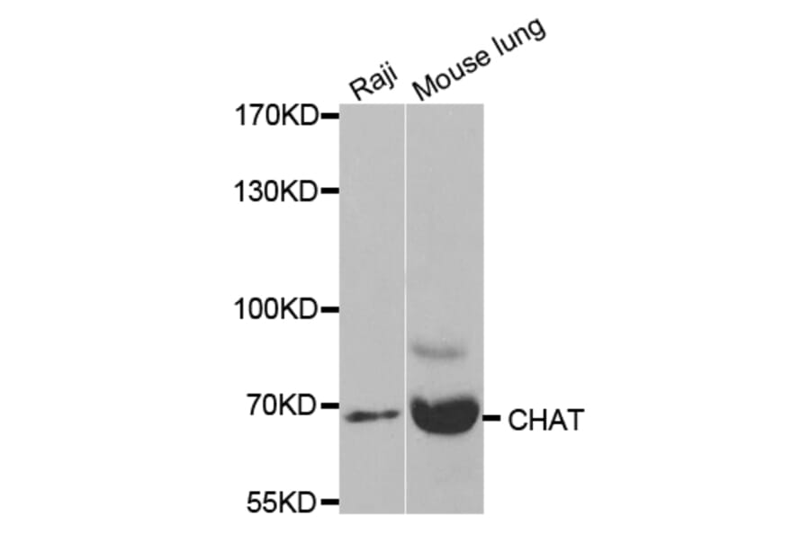 Western blot - CHAT Antibody from Signalway Antibody (32673) - Antibodies.com