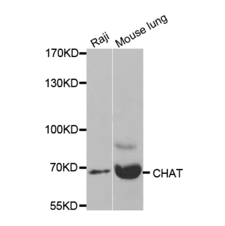 Western blot - CHAT Antibody from Signalway Antibody (32673) - Antibodies.com