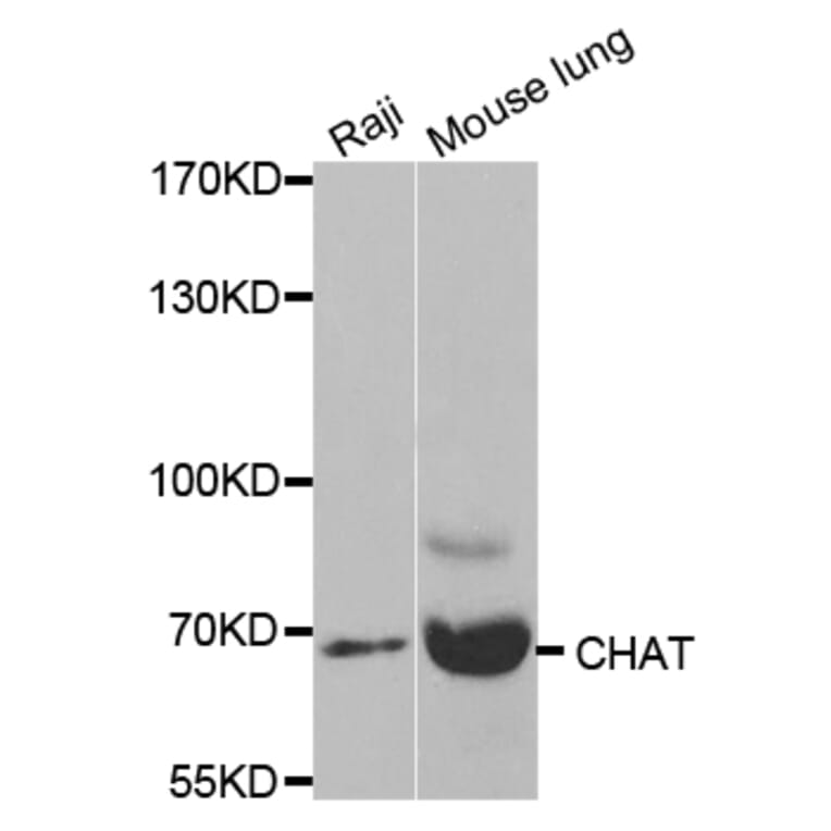 Western blot - CHAT Antibody from Signalway Antibody (32673) - Antibodies.com