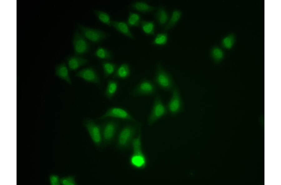 Immunofluorescence - CHAT Antibody from Signalway Antibody (32673) - Antibodies.com