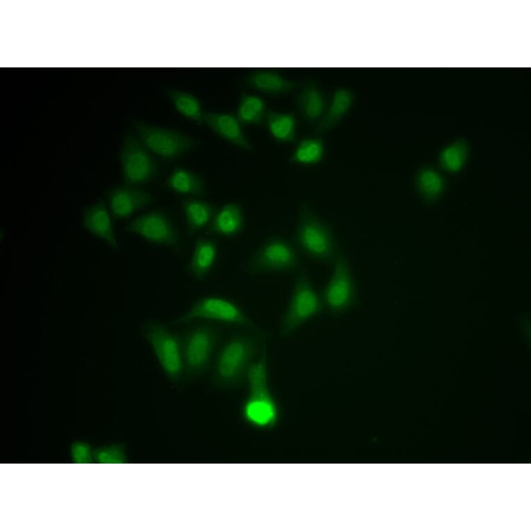 Immunofluorescence - CHAT Antibody from Signalway Antibody (32673) - Antibodies.com