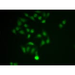 Immunofluorescence - CHAT Antibody from Signalway Antibody (32673) - Antibodies.com