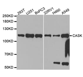 Western blot - CASK Antibody from Signalway Antibody (32678) - Antibodies.com