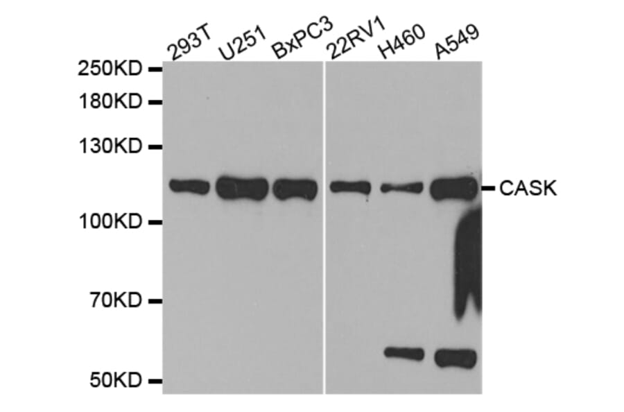 Western blot - CASK Antibody from Signalway Antibody (32678) - Antibodies.com