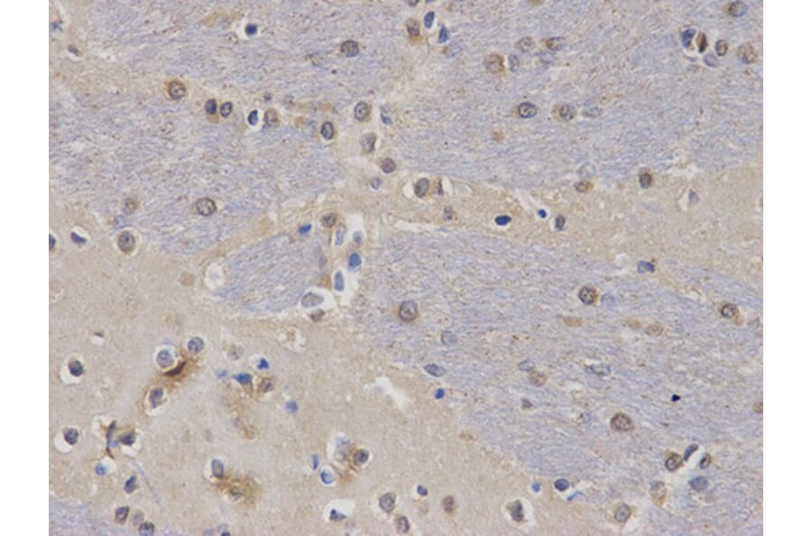 Immunohistochemistry - CASK Antibody from Signalway Antibody (32678) - Antibodies.com