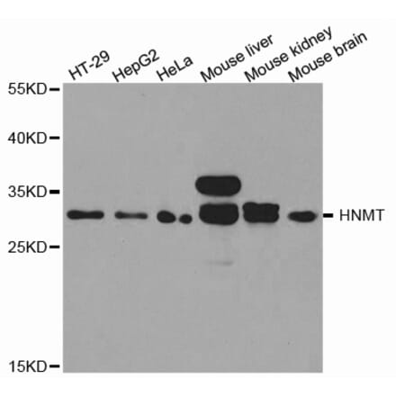 Western blot - HNMT Antibody from Signalway Antibody (32688) - Antibodies.com