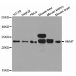 Western blot - HNMT Antibody from Signalway Antibody (32688) - Antibodies.com