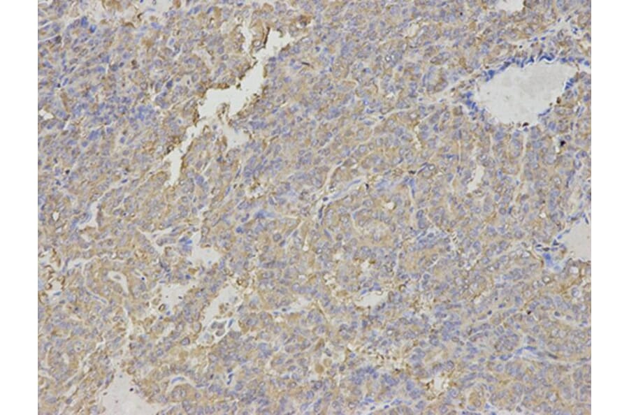 Immunohistochemistry - HNMT Antibody from Signalway Antibody (32688) - Antibodies.com