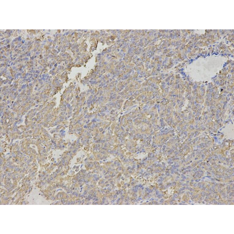 Immunohistochemistry - HNMT Antibody from Signalway Antibody (32688) - Antibodies.com