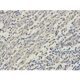 Immunohistochemistry - HNMT Antibody from Signalway Antibody (32688) - Antibodies.com