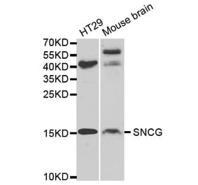 Western blot - SNCG Antibody from Signalway Antibody (32690) - Antibodies.com