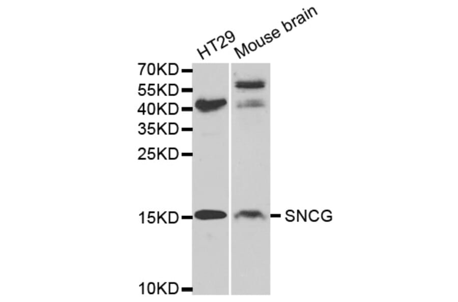 Western blot - SNCG Antibody from Signalway Antibody (32690) - Antibodies.com