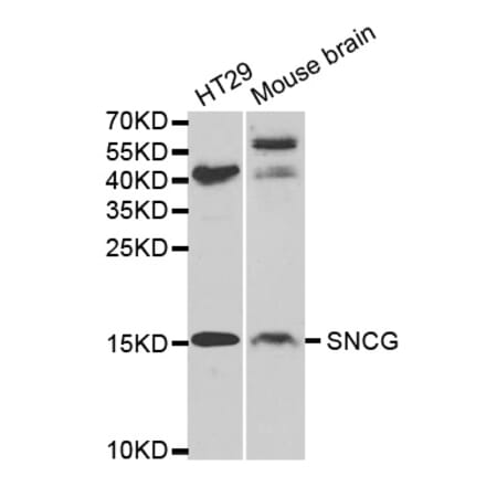 Western blot - SNCG Antibody from Signalway Antibody (32690) - Antibodies.com