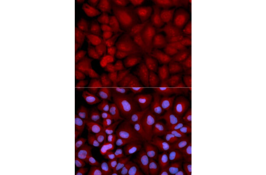 Immunofluorescence - SNCG Antibody from Signalway Antibody (32690) - Antibodies.com