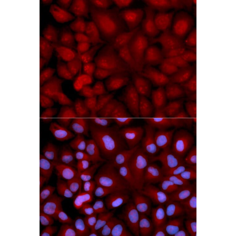 Immunofluorescence - SNCG Antibody from Signalway Antibody (32690) - Antibodies.com