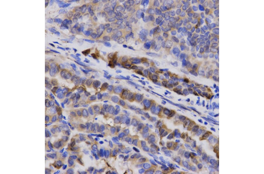Immunohistochemistry - SNCG Antibody from Signalway Antibody (32690) - Antibodies.com