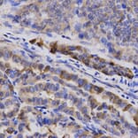 Immunohistochemistry - SNCG Antibody from Signalway Antibody (32690) - Antibodies.com