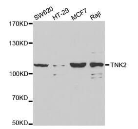 Western blot - TNK2 Antibody from Signalway Antibody (32692) - Antibodies.com