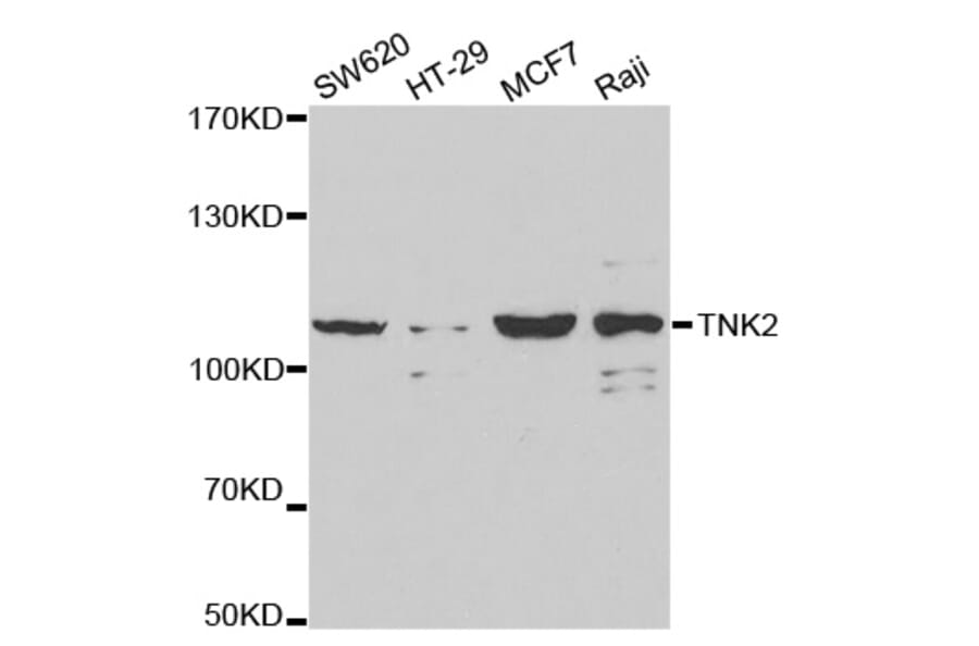 Western blot - TNK2 Antibody from Signalway Antibody (32692) - Antibodies.com