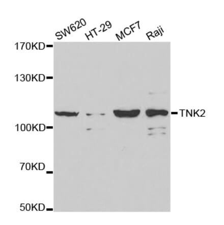 Western blot - TNK2 Antibody from Signalway Antibody (32692) - Antibodies.com